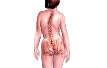 Dzemdes kakla osteohondrozes attīstības iemesli