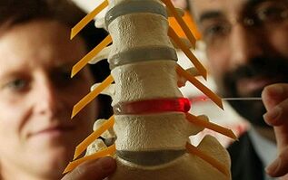 Krūšu mugurkaula osteohondrozes simptomi un ārstēšana
