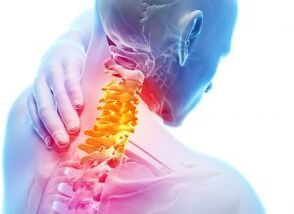 Sāpes un šaušana dzemdes kakla rajonā ar trešās pakāpes osteohondrozi