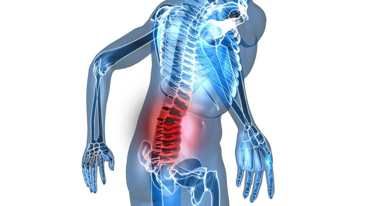 mugurkaula jostas daļas osteohondroze